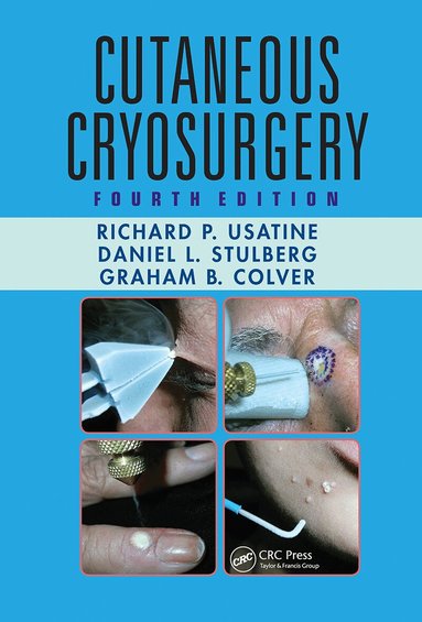Richard P. Usatine, Daniel L. Stulberg, Graham B. Colver - Cutaneous Cryosurgery, Häftad