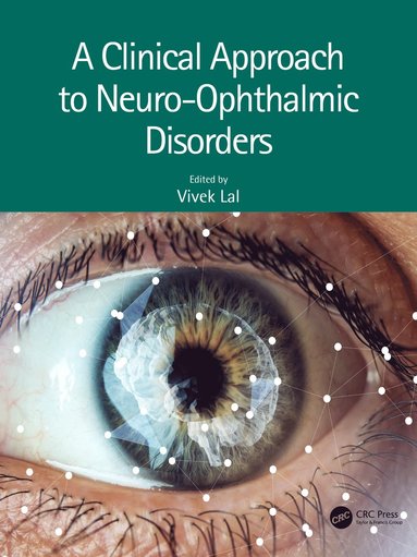 bokomslag Clinical Approach to Neuro-Ophthalmic Disorders