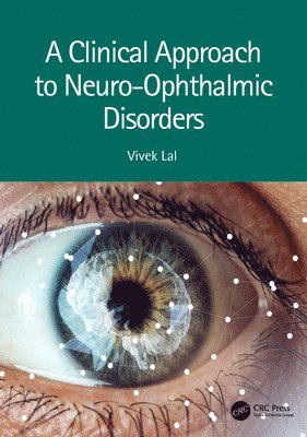 A Clinical Approach to Neuro-Ophthalmic Disorders 1