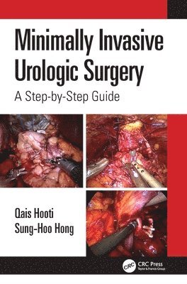 bokomslag Minimally Invasive Urologic Surgery