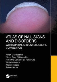 bokomslag Atlas of Nail Signs and Disorders with Clinical and Onychoscopic Correlation