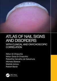 bokomslag Atlas of Nail Signs and Disorders with Clinical and Onychoscopic Correlation