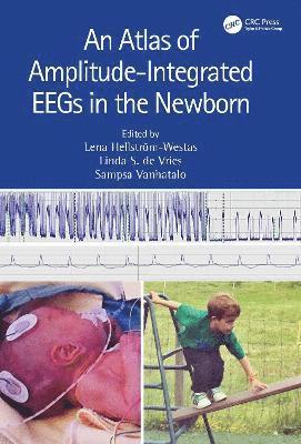 bokomslag An Atlas of Amplitude-Integrated EEGs in the Newborn