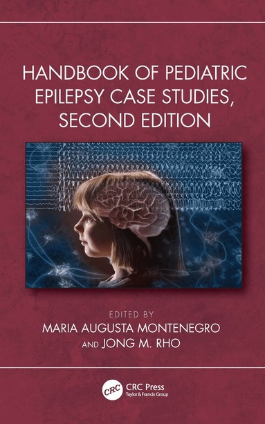 Maria Augusta Montenegro, Jong M. Rho - Handbook of Pediatric Epilepsy Case Studies, Second Edition, Häftad