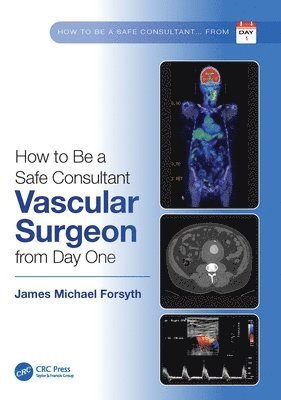 James Forsyth - How to be a Safe Consultant Vascular Surgeon from Day One, Häftad