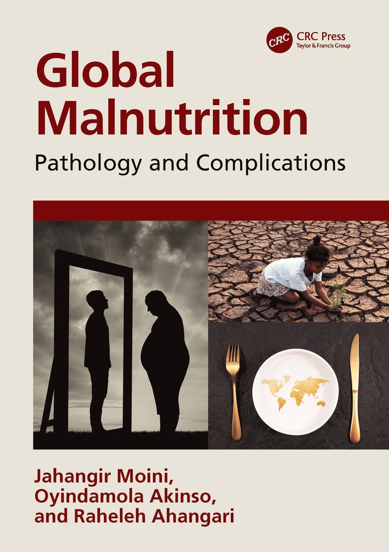 Jahangir Moini, Oyindamola Akinso, Raheleh Ahangari, USA) Moini, Jahangir (Eastern Florida State College - Global Malnutrition, Inbunden