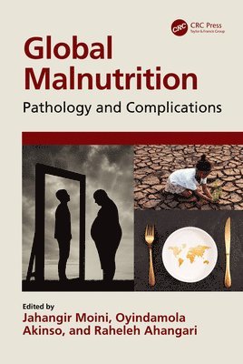 Global Malnutrition 1