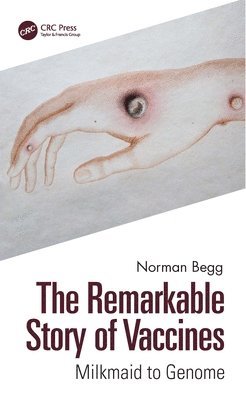 Norman Begg - Remarkable Story of Vaccines, Inbunden