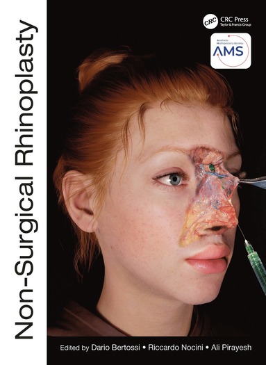 bokomslag Non-Surgical Rhinoplasty