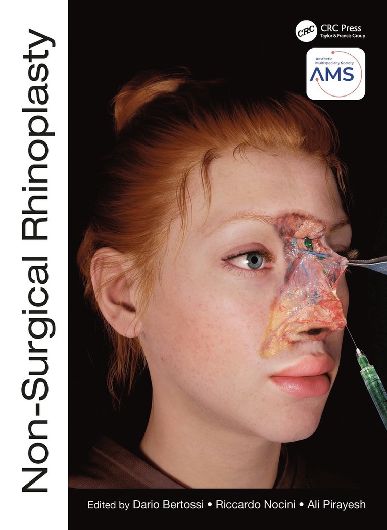 Non-Surgical Rhinoplasty 1