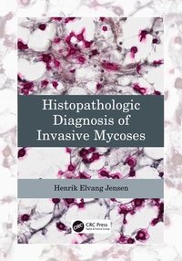 bokomslag Histopathologic Diagnosis of Invasive Mycoses