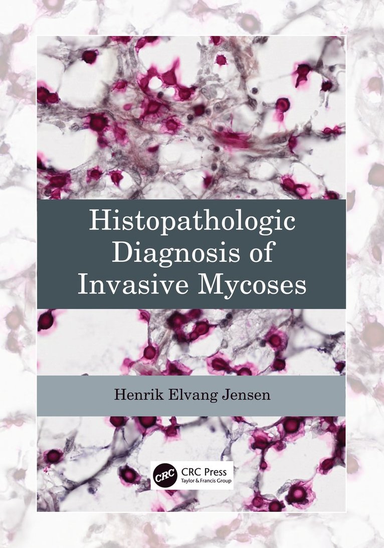 Henrik Elvang Jensen, Denmark) Jensen, Henrik Elvang (University of Copenhagen - Histopathologic Diagnosis of Invasive Mycoses, Häftad