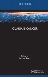 bokomslag Ovarian Cancer