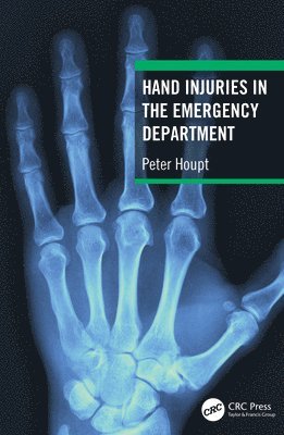 bokomslag Hand Injuries in the Emergency Department