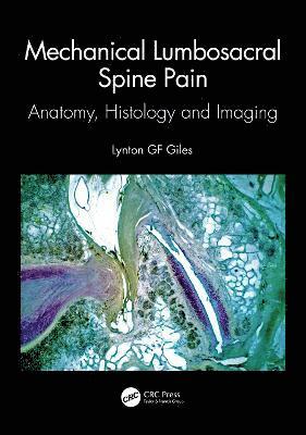 Mechanical Lumbosacral Spine Pain 1