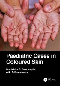 bokomslag Paediatric Cases in Coloured Skin
