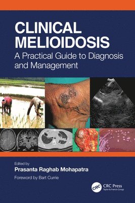 Clinical Melioidosis 1