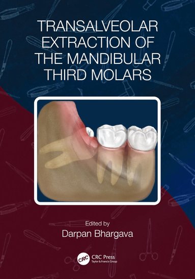 bokomslag Transalveolar Extraction of the Mandibular Third Molars