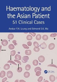 bokomslag Haematology and the Asian Patient