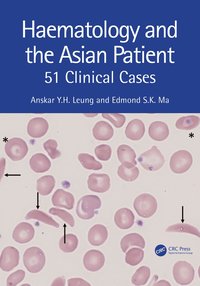 bokomslag Haematology and the Asian Patient