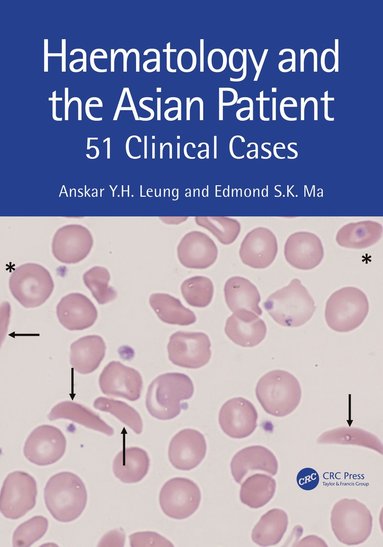 bokomslag Haematology and the Asian Patient