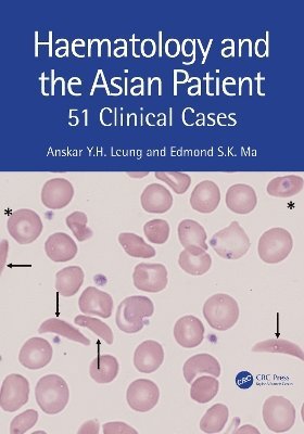Haematology and the Asian Patient 1