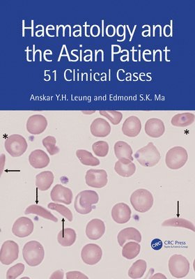 Haematology and the Asian Patient 1