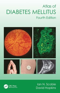 bokomslag Atlas of Diabetes Mellitus