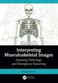 bokomslag Interpreting Musculoskeletal Images