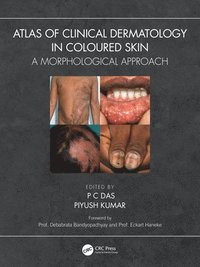 bokomslag Atlas of Clinical Dermatology in Coloured Skin