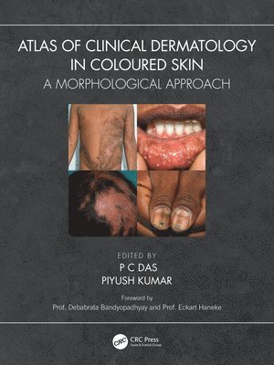 Atlas of Clinical Dermatology in Coloured Skin 1