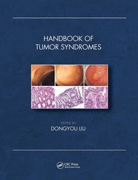 bokomslag Handbook of Tumor Syndromes