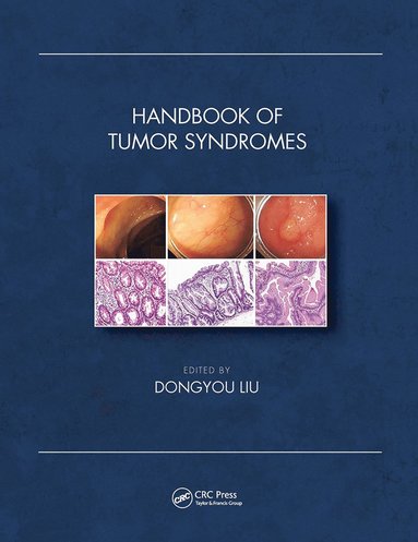 bokomslag Handbook of Tumor Syndromes