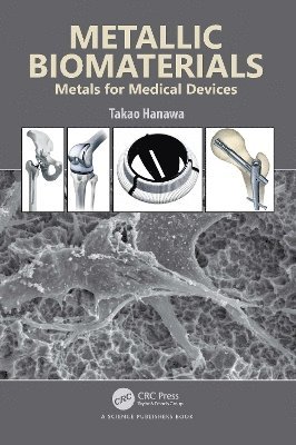 Metallic Biomaterials 1