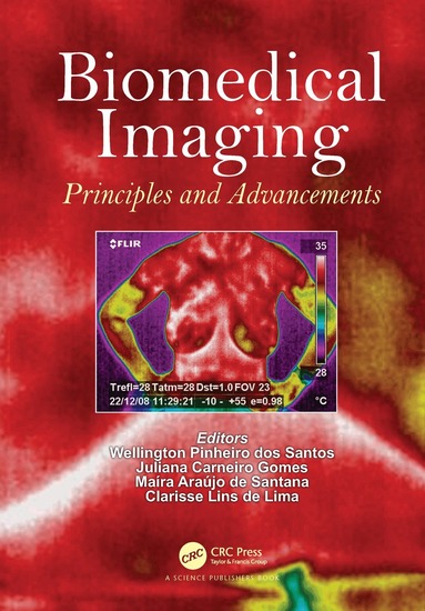 Wellington Pinheiro dos Santos, Juliana Carneiro Gomes, Maíra Araújo de Santana, Clarisse Lins de Lima - Biomedical Imaging, Inbunden