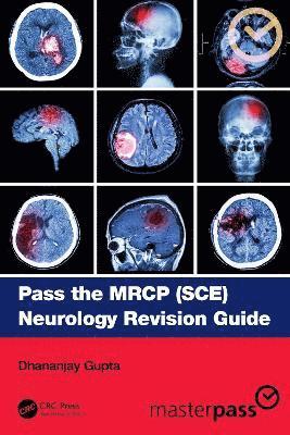 Dhananjay Gupta - Pass the MRCP (SCE) Neurology Revision Guide, Häftad