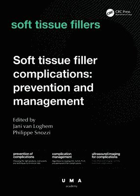 Jani van Loghem, Philippe Snozzi, Netherlands) Loghem, Jani van (Founder, UMA Institute, Amsterdam, Switzerland) Snozzi, Philippe (Aesthetic Physician, Smoothline, Zurich, Jani Van Loghem - Soft Tissue Filler Complications, Inbunden