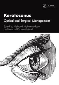 bokomslag Keratoconus