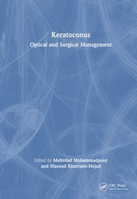 bokomslag Keratoconus