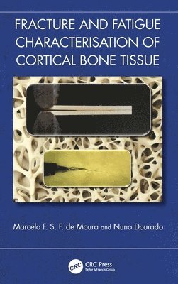 bokomslag Fracture and Fatigue Characterization of Cortical Bone Tissue