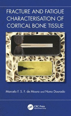 Marcelo F. S. F. de Moura, Nuno Dourado, Portugal) de Moura, Marcelo F. S. F. (Universidade do Porto - Fracture and Fatigue Characterisation of Cortical Bone Tissue, Inbunden