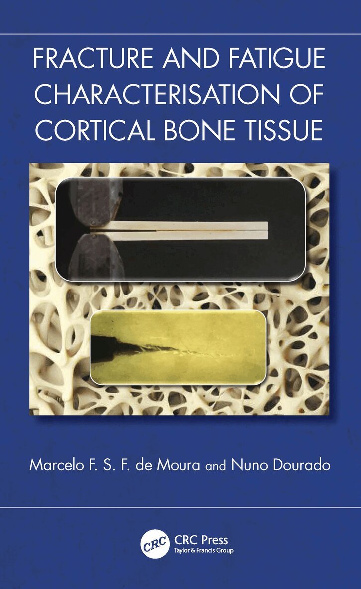 Marcelo F. S. F. de Moura, Nuno Dourado - Fracture and Fatigue Characterisation of Cortical Bone Tissue, Häftad