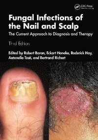 bokomslag Fungal Infections of the Nail and Scalp