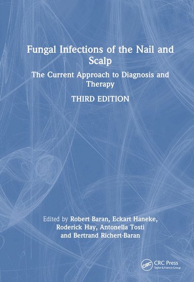 Robert Baran, Eckart Haneke, Roderick Hay, Antonella Tosti, Bertrand Richert-Baran - Fungal Infections of the Nail and Scalp, Inbunden