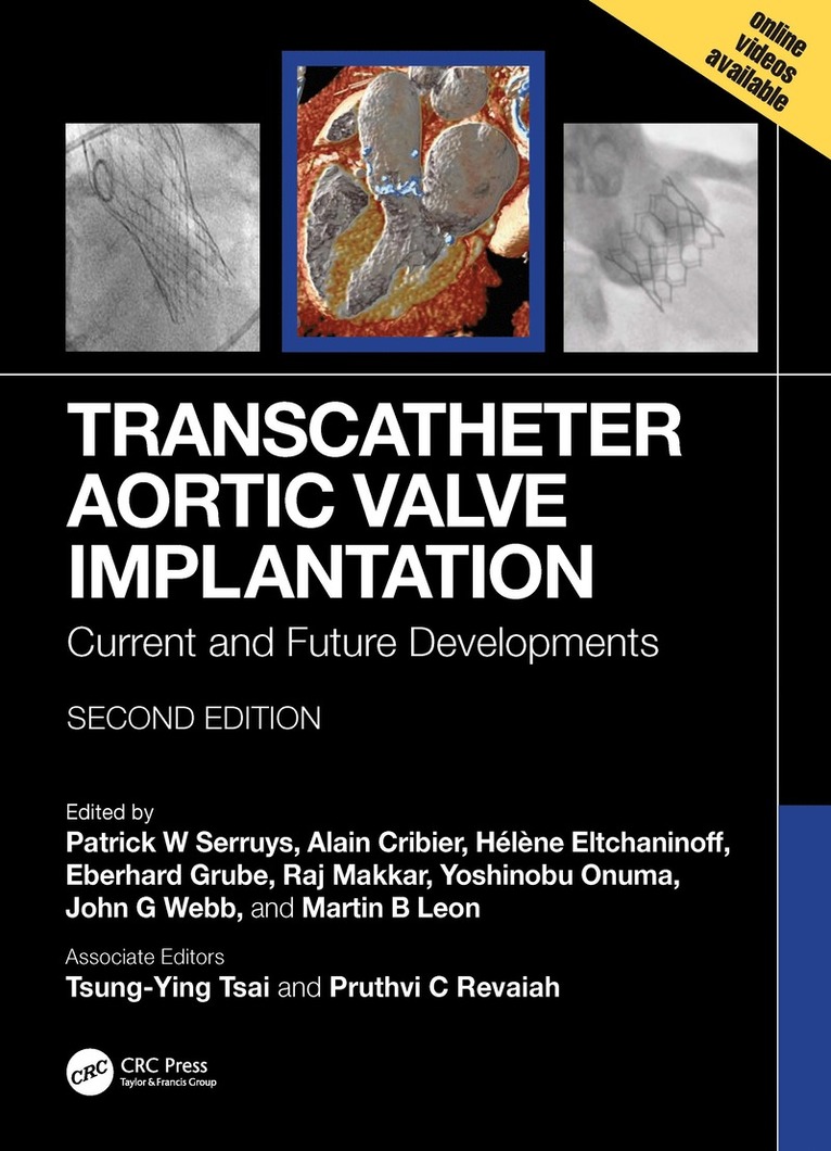 Patrick W. Serruys, Alain Cribier, Helene Eltchaninoff, Eberhard Grube, Raj Makkar, Yoshinobu Onuma, John G. Webb, Martin B. Leon, Rotterdam.) Serruys, Patrick W. (Interventional Dept, Heartcenter Rotterdam; Thoraxcenter, EMC, Rouen.) Cribier, Alain (UHC, Rouen.) Eltchaninoff, Helene (UHC, Germany) Grube, Eberhard (Univ Hospital Bonn, USA) Makkar, Raj (Smidt Heart Inst., Ireland) Onuma, Yoshinobu (CORRIB Core Lab, Canada) Webb, John G. (St. Paul’s Hospital, Univ of British Columbia, USA) Leon, Martin B. (Columbia Univ. Irving Med Center, Patrick W Serruys, John G Webb, Martin B Leon - Transcatheter Aortic Valve Implantation, Inbunden
