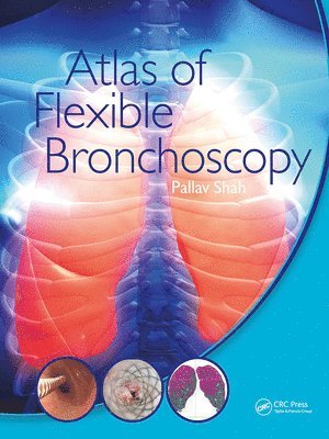 bokomslag Atlas of Flexible Bronchoscopy
