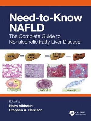 bokomslag Need-to-Know NAFLD