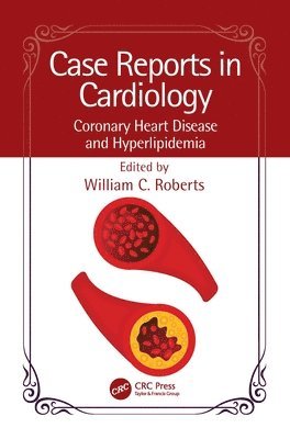 William C. Roberts, Dallas) Roberts, William C. (Baylor Heart and Vascular Institute, Baylor University Medical Center - Case Reports in Cardiology, Häftad