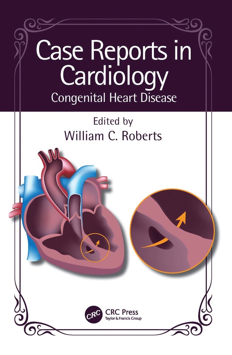 William C. Roberts, Dallas) Roberts, William C. (Baylor Heart and Vascular Institute, Baylor University Medical Center - Case Reports in Cardiology, Häftad
