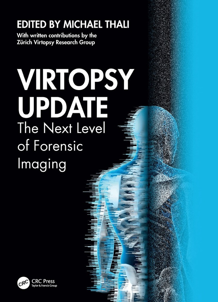 Virtopsy Update
